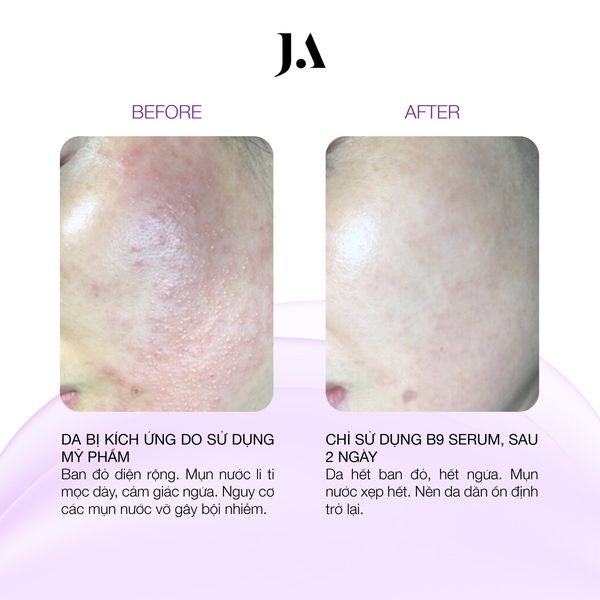 Serum Juliette Armand Elements Folic Acid B9 CT - Ảnh 8
