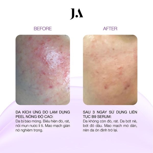 Serum Juliette Armand Elements Folic Acid B9 CT - Ảnh 7